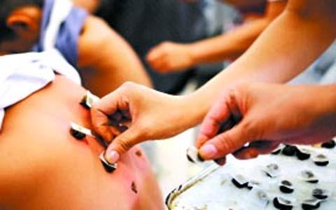 久治不愈的咳嗽麻辣敷贴“贴”好